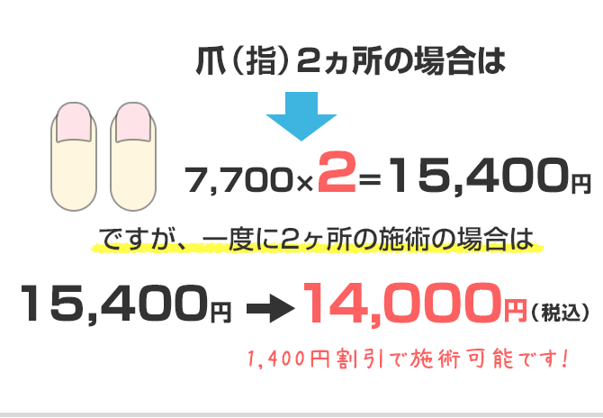 爪2ヵ所14000円
